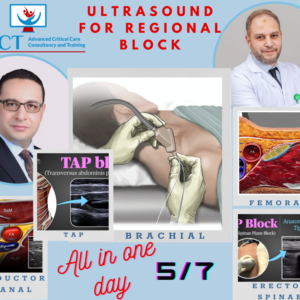 Ultrasound for regional block